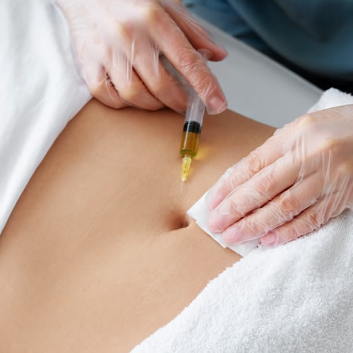 aplicação de enzimas em Guarulhos Uemura Estética