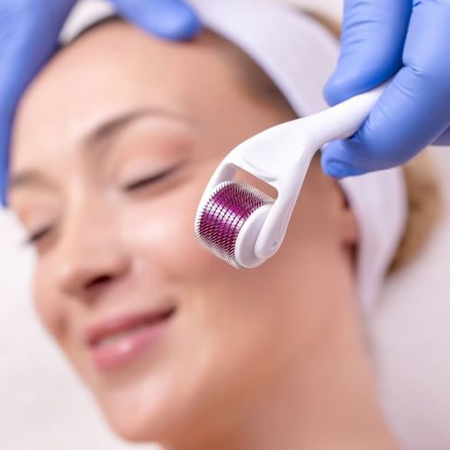 microagulhamento-em-guarulhos-na-uemura-estetica-Guarulhos-Estetica-facial-Estetica-em-Guarulhos