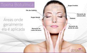 botox-em-guarulhos-uemura-estetica-em-guarulhos-harmonizacao-facial-em-guarulhos-toxina-botulinica-em-guarulhos