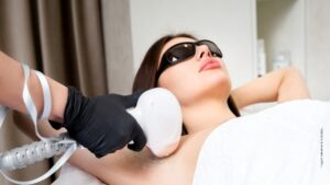 depilação a laser uemura estetica guarulhos