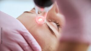 Lavieen em Guarulhos Laser de Thulium Uemura Estética Guarulhos