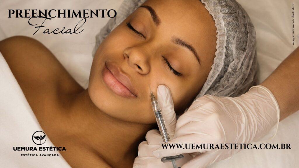 Botox Estética em Guarulhos Bioestimulador Sculptra Radiesse Preenchimento facial Guarulhos Uemura Estética