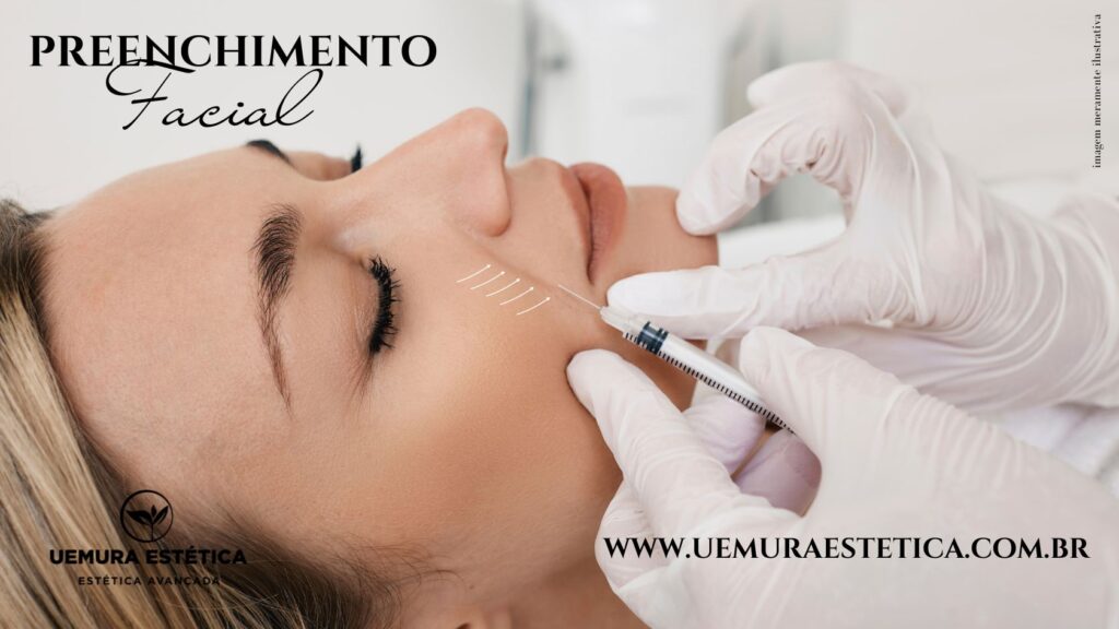 Botox Estética em Guarulhos Bioestimulador Sculptra Radiesse Preenchimento facial Guarulhos Uemura Estética