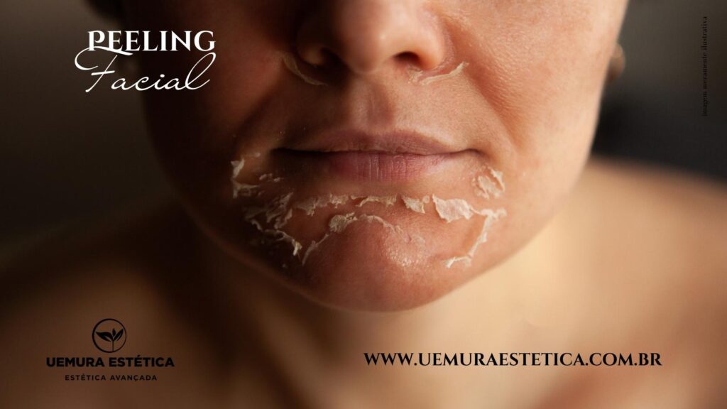 estetica-facial-peeling-facial-em-guarulhos-uemura-estetica-tratamento-facial-Guarulhos