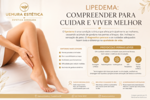 Mulher com sintomas de lipedema como pernas pesadas, inchaço e desconforto nas pernas.